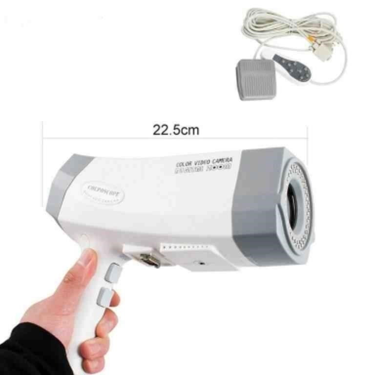 Digital Electronic Colposcope Camera